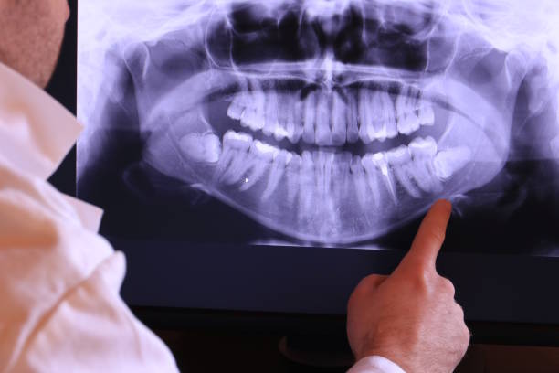 Best Emergency Dental Care for Broken or Chipped Teeth in Meadow Woods, FL